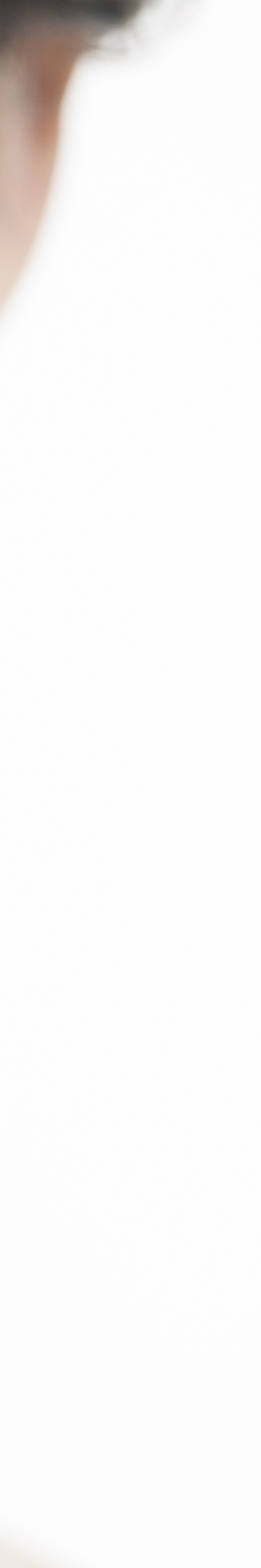 라미네이트 재시술 완벽한 미소를 위한 두 번째 여정 관련 이미지 31