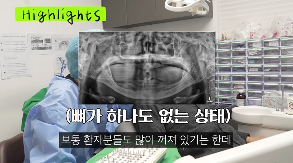 압구정치과 뼈이식 없는 임플란트 나도 가능할까 관련 이미지 11