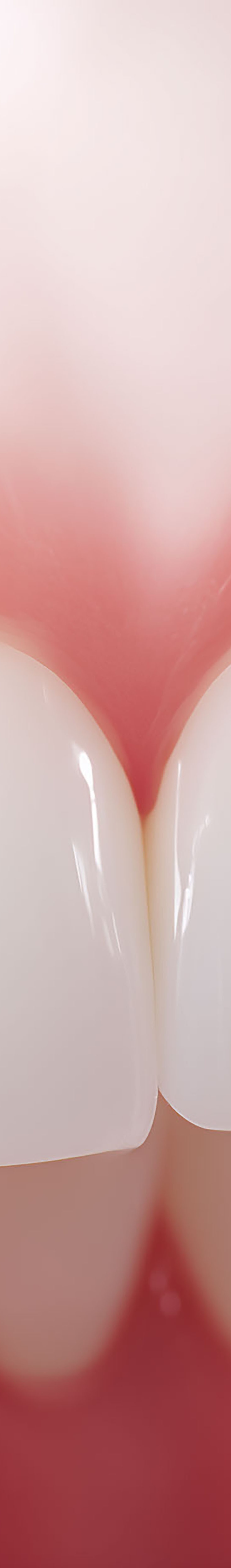 압구정로데오치과 라미네이트 어떤 포인트를 체크해야 할까 관련 이미지 24