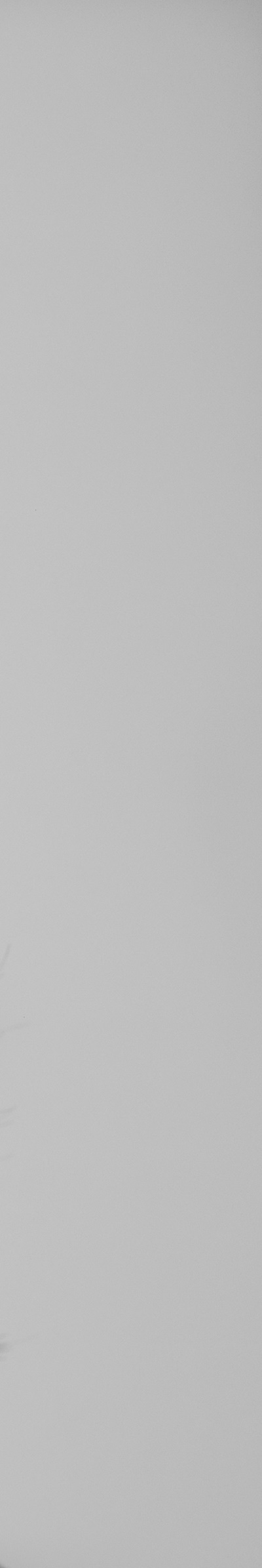 전체임플란트잘하는곳 치아 고민 끝에 만난 새로운 시작 관련 이미지 31