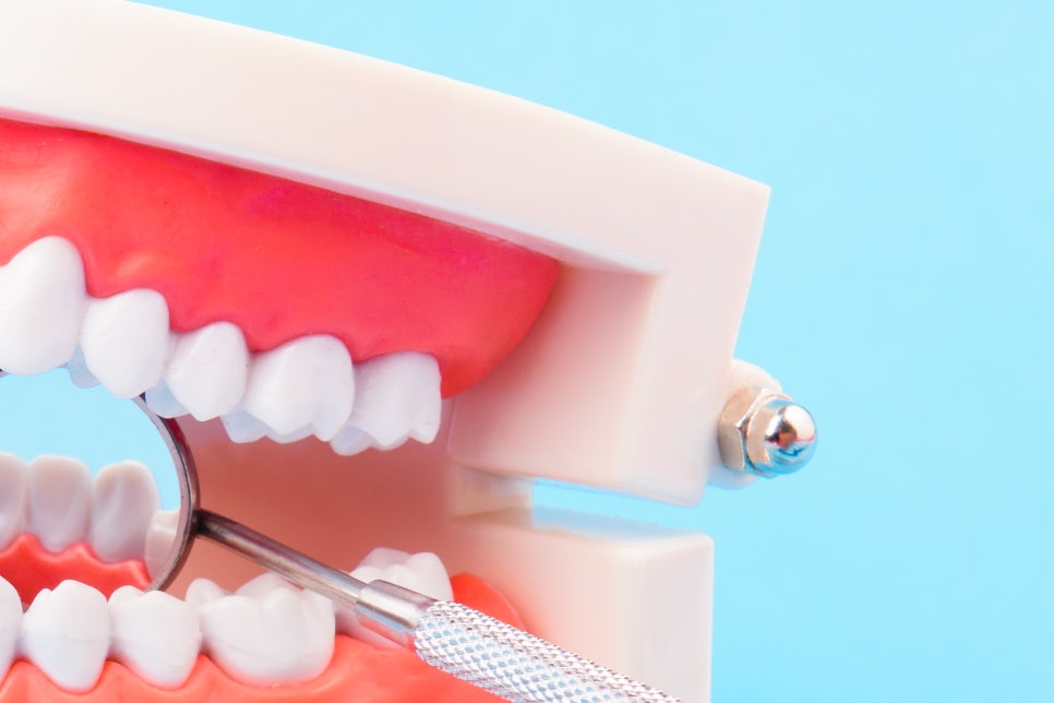 풀아치임플란트 불편한 틀니와 작별해요! 관련 이미지 14