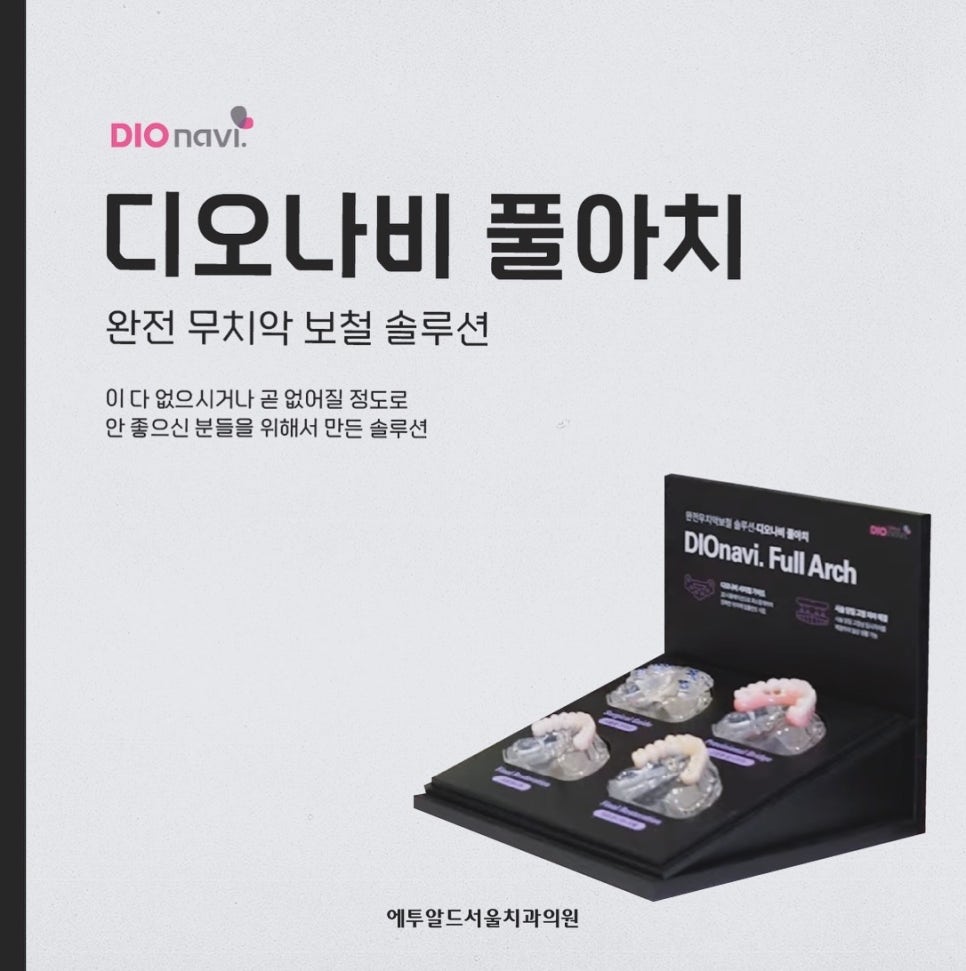 디지털 풀아치 임플란트 정말 두달이면 다 끝나나요? 관련 이미지 9