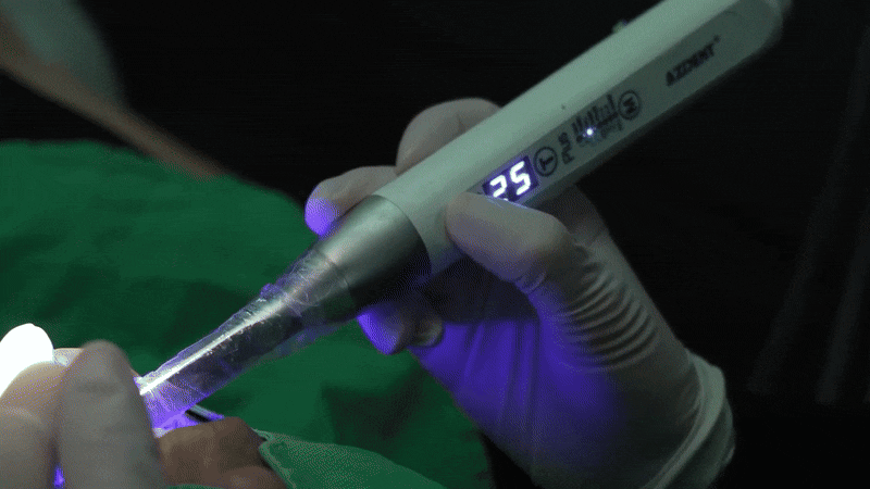 전체임플란트추천 식사의 즐거움을 되찾는 여정 관련 이미지 5