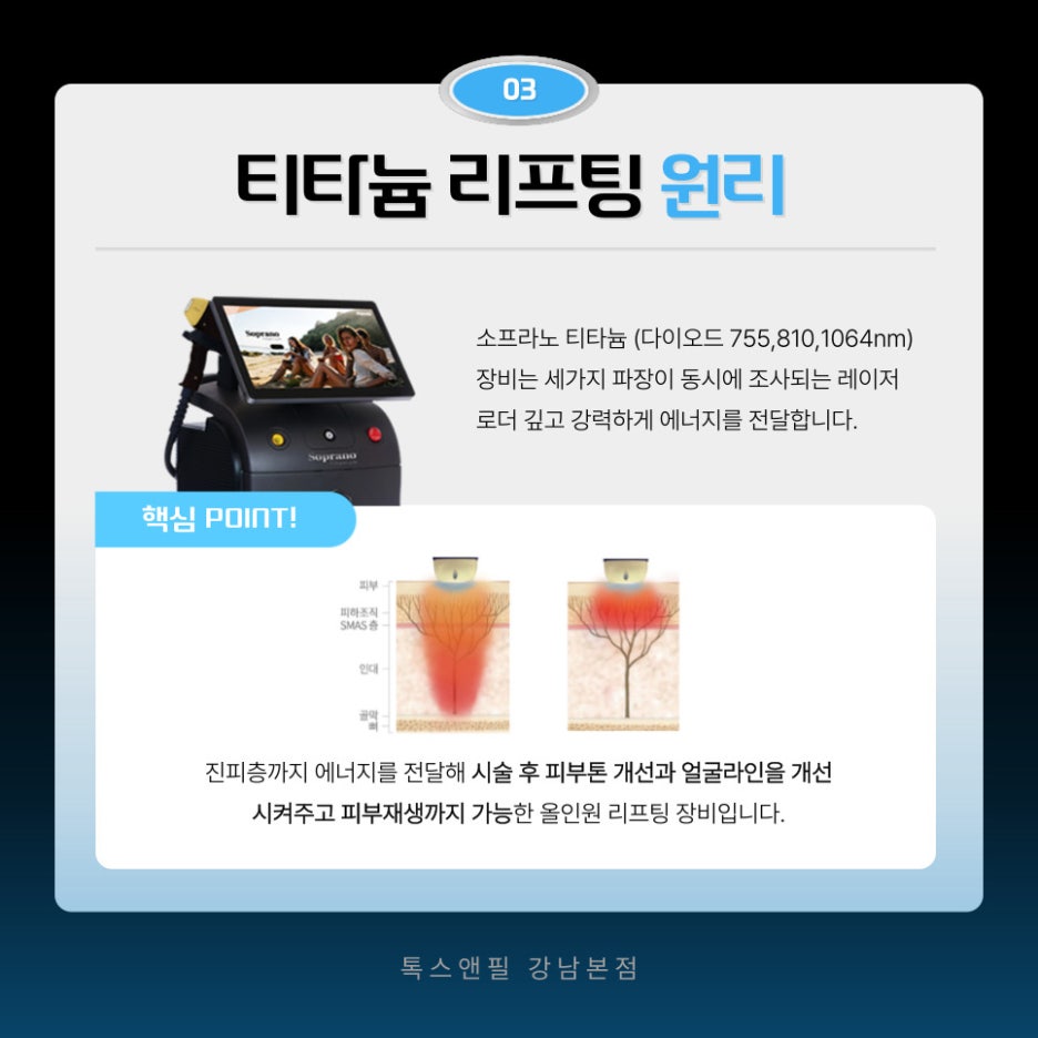 강남 티타늄리프팅 동안외모를 위한 방법 알려드립니다 관련 이미지 4