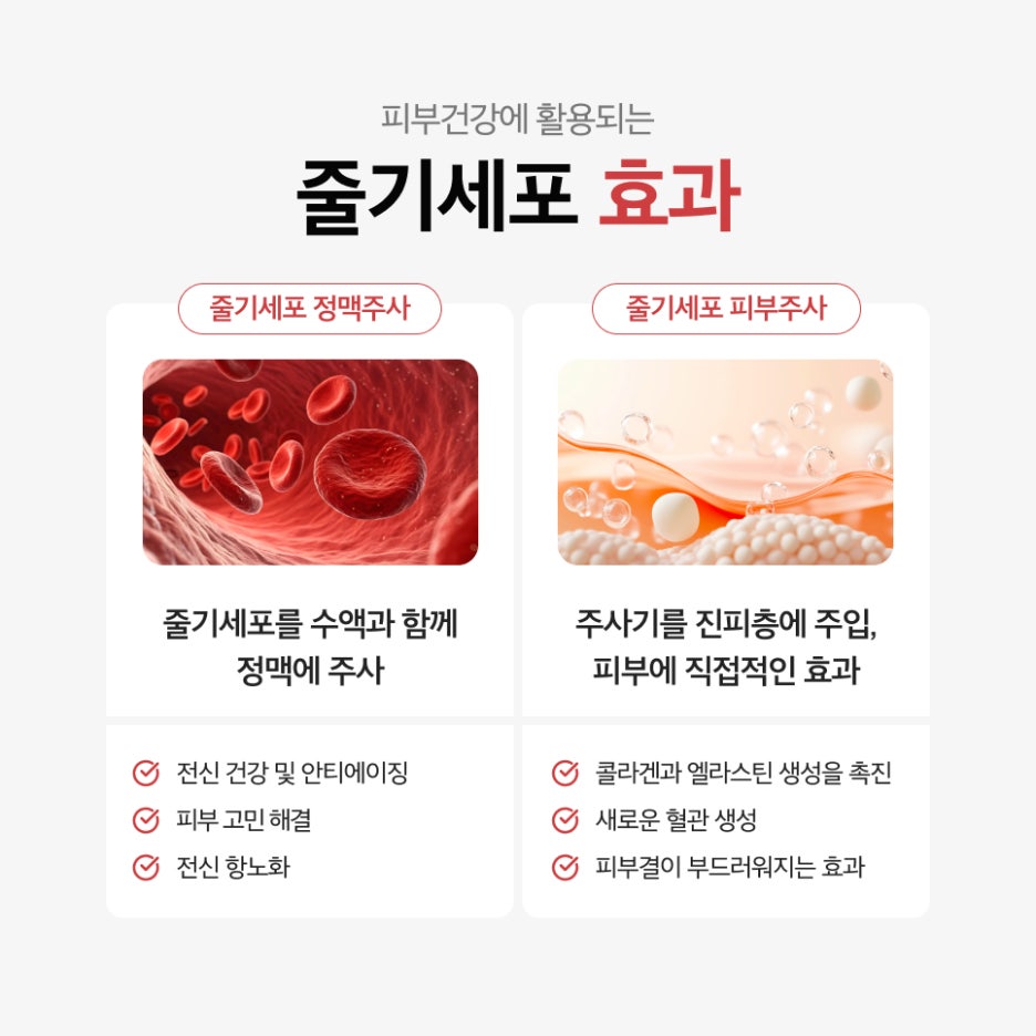 강남 줄기세포주사 내 세포로 되살리는 MCT 메타셀 관련 이미지 3