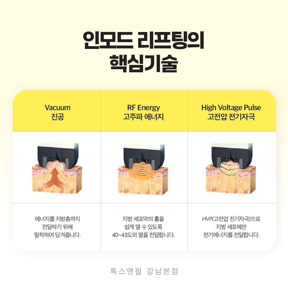 강남역 인모드 가격 알아보기! 관련 이미지 5