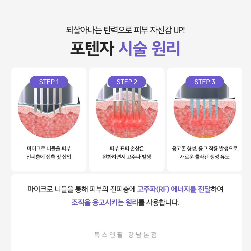 What to Know About the Effects and Side Effects Before Gangnam Potenza Treatment image 3