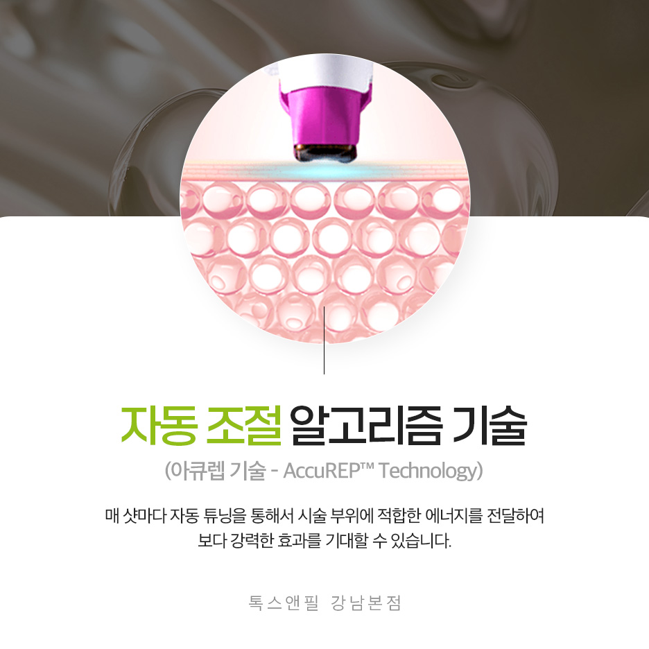 신논현써마지 받기 전이라면, 꼭 읽어보세요! 관련 이미지 4