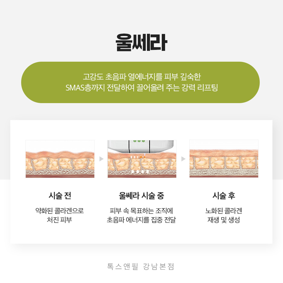 강남역 울쎄라 탄력잃은 피부로 고민이라면? 관련 이미지 4