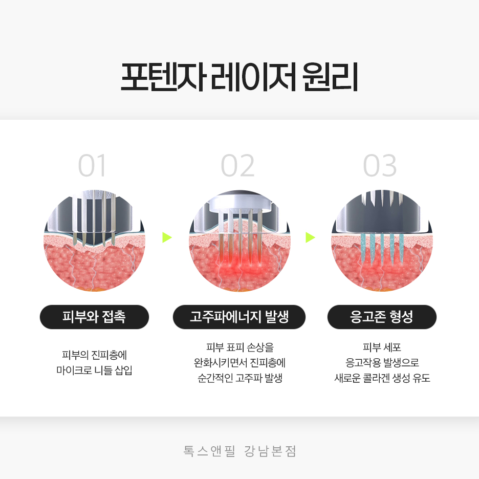 강남역포텐자, 모공 때문에 고민이라면 집중해 주세요. 관련 이미지 6