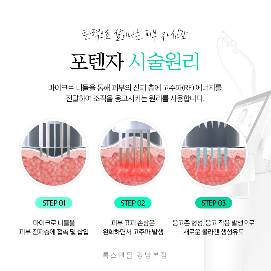 포텐자성지 탄력으로 살아나는 피부 자신감 관련 이미지 3
