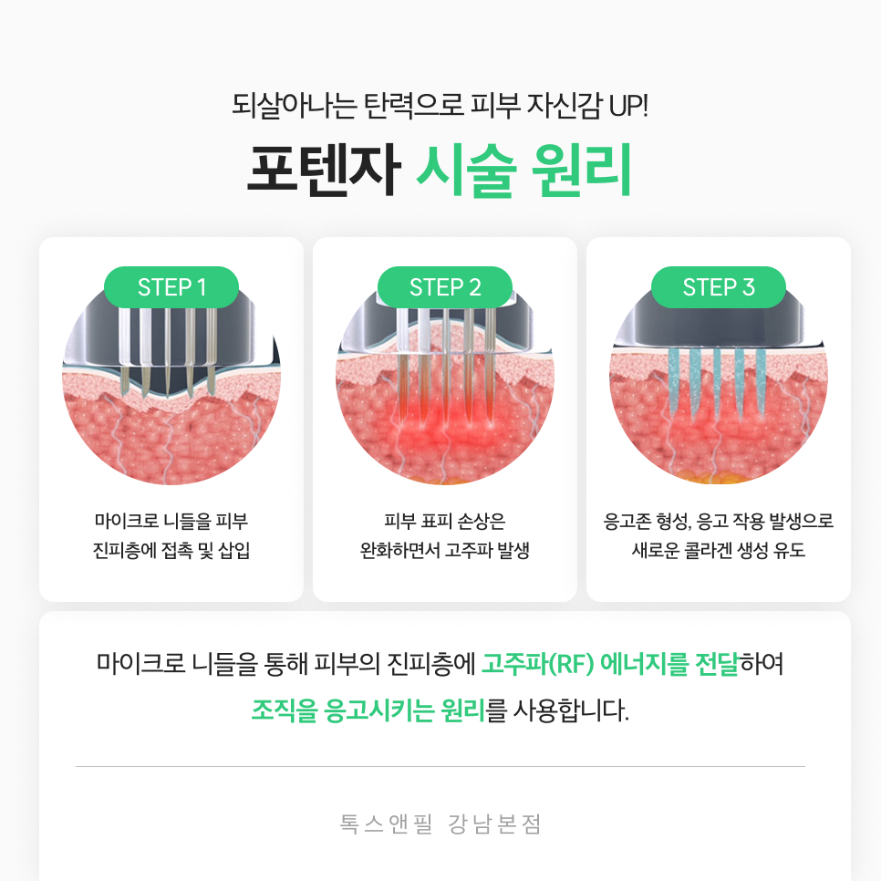 강남 포텐자레이저 탄력있고 매끄러운 피부를 위한 선택 관련 이미지 3