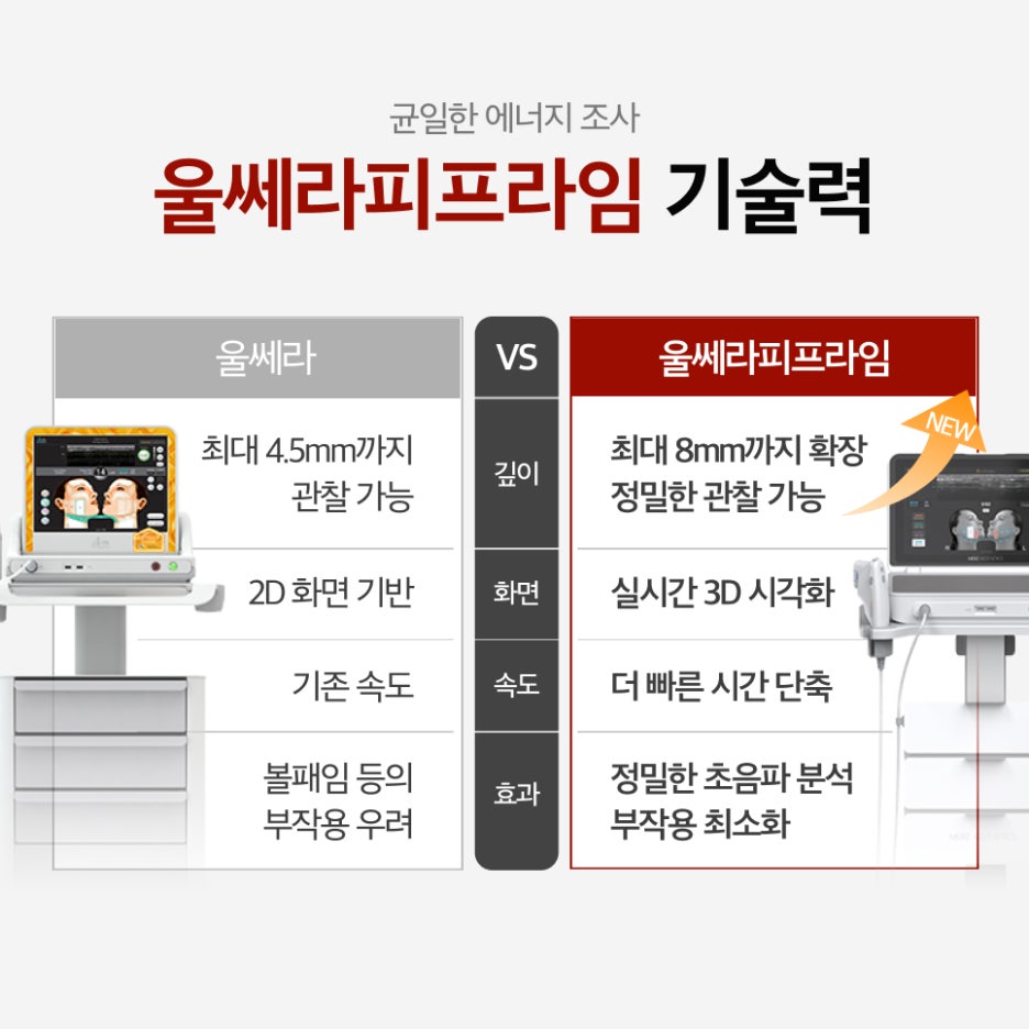 서초울쎄라피프라임가격 내부에서 생성하는 콜라겐과 엘라스틴 관련 이미지 3