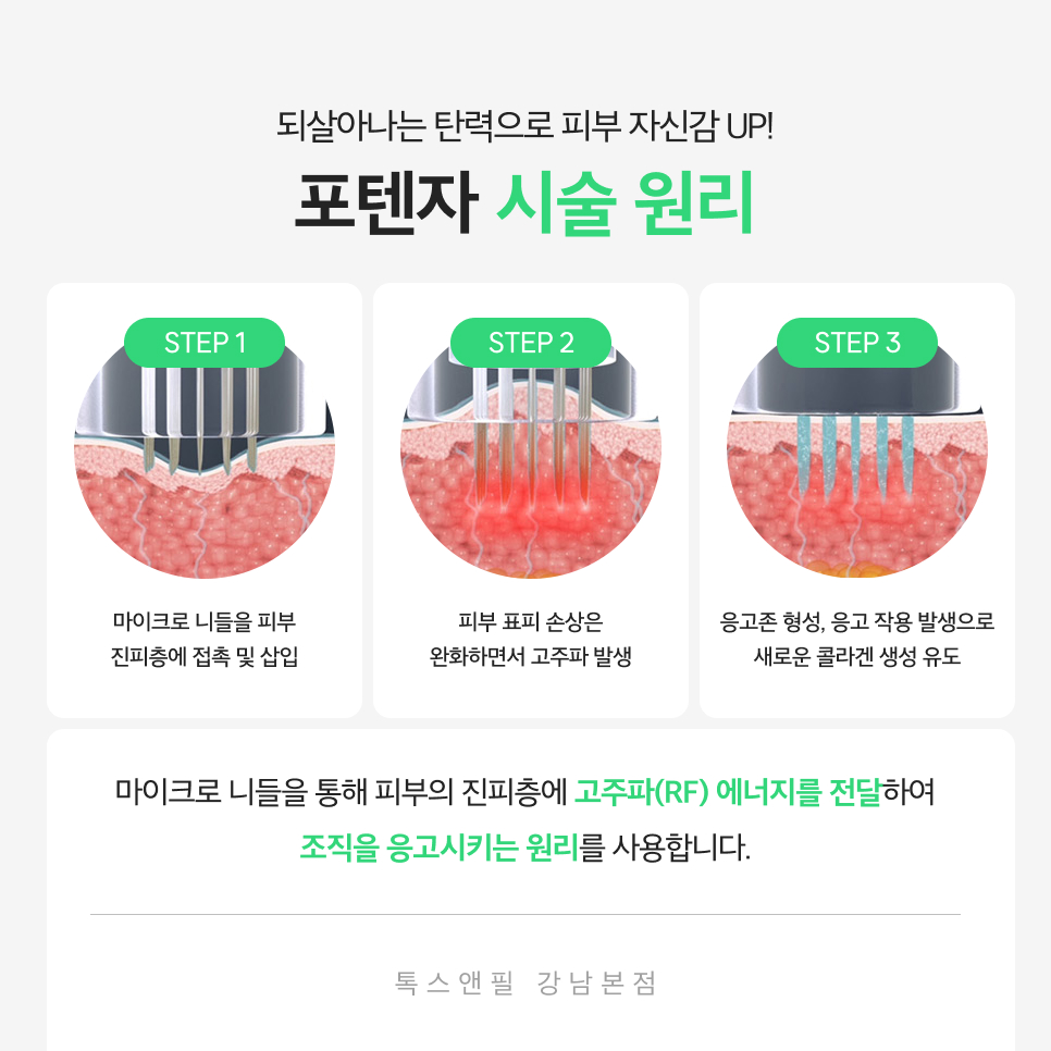 강남포텐자 피부 고민을 해결해보세요 관련 이미지 3