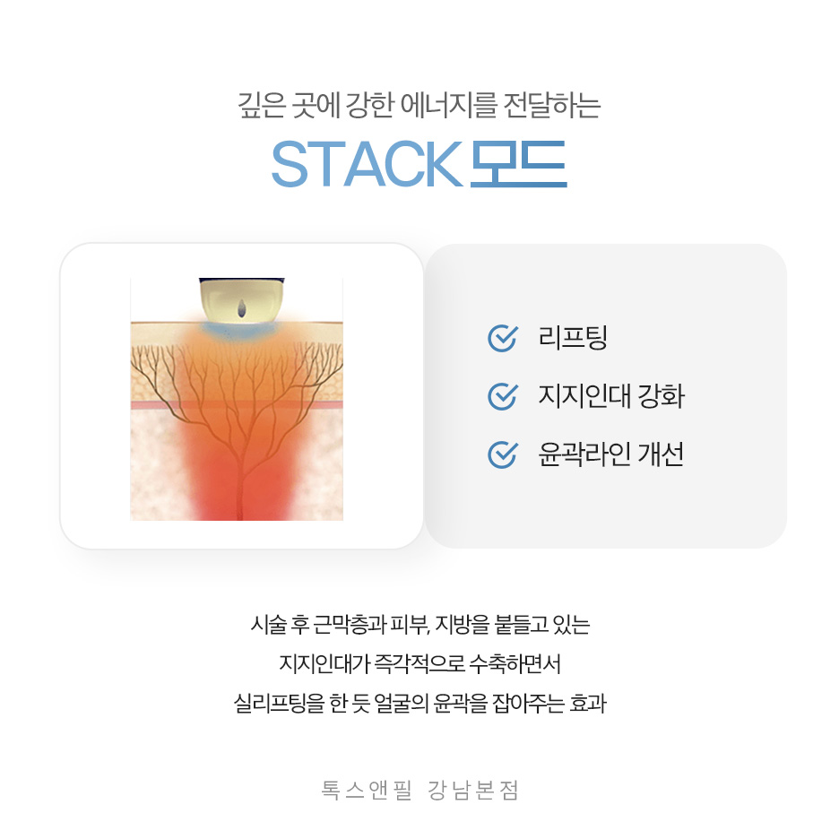 강남역 티타늄리프팅 효과와 통증, 가격 모두 알려드립니다 관련 이미지 3