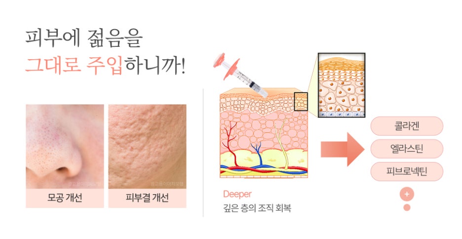 강남역엘라비에리투오 미래를 위한 투자 스킨부스터 알아보고 있다면? 관련 이미지 4