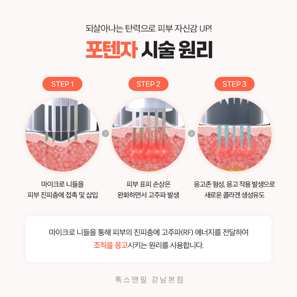 강남포텐자 시술 전 알아야 할 효과와 부작용은? 관련 이미지 3