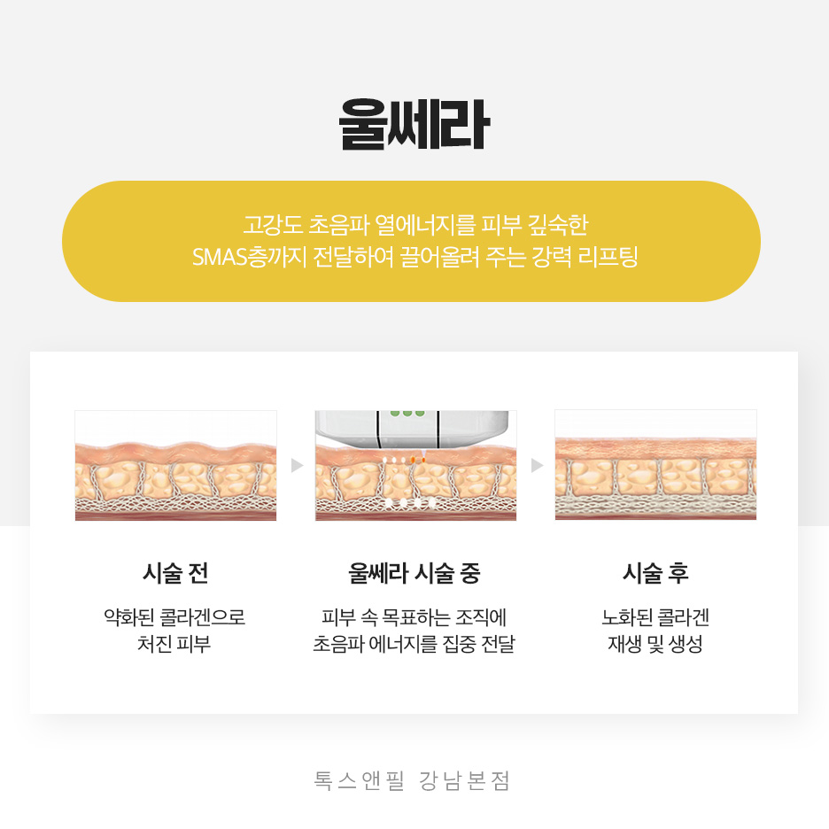 강남역 인모드 써마지 피부관리의 첫걸음 관련 이미지 4