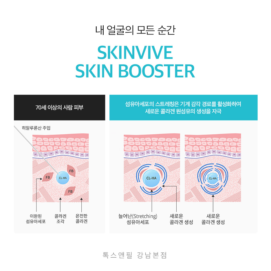 강남스킨바이브 가격, 후기부터 효과까지 관련 이미지 4