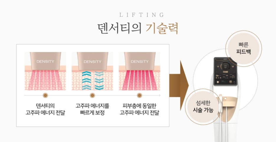 서초덴서티비용 계절 타이밍, 리프팅 효과를 좌우할까 관련 이미지 5