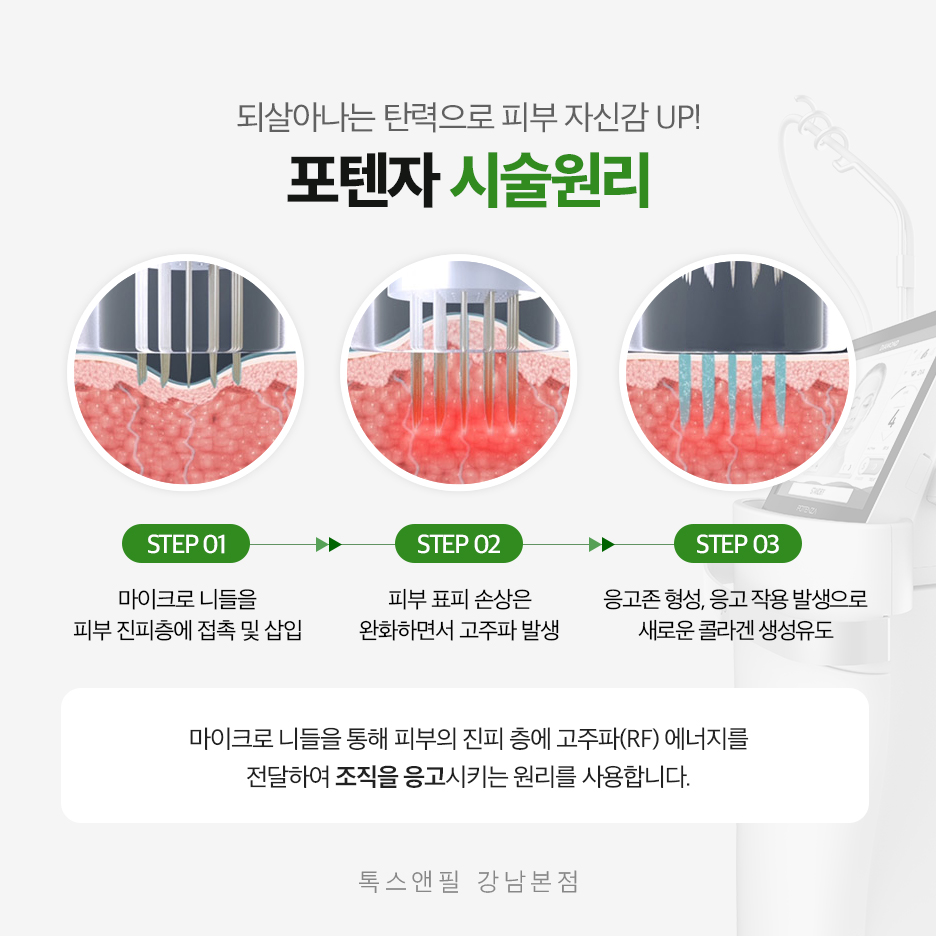 강남역포텐자 피부고민에서 벗어나자 관련 이미지 3