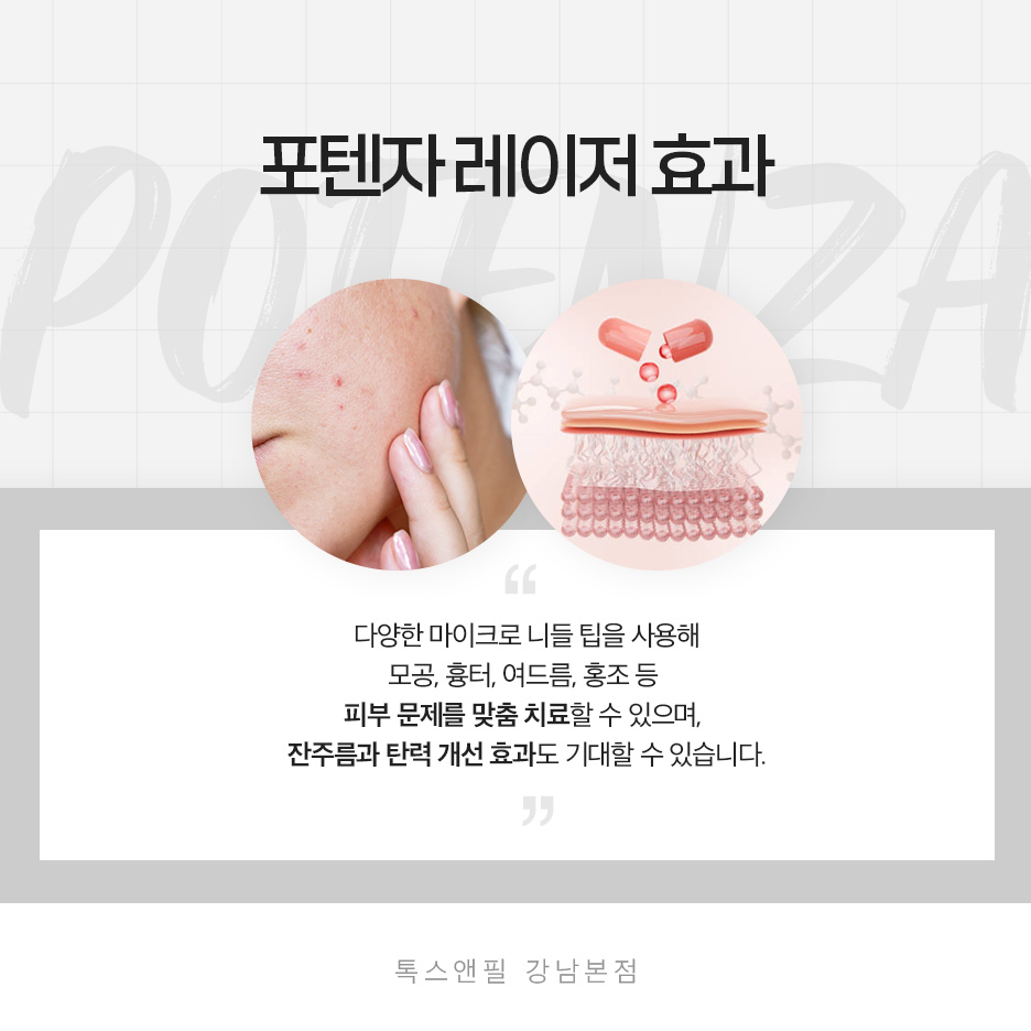 강남역 포텐자 여드름 흉터로 고민이라면? 관련 이미지 3