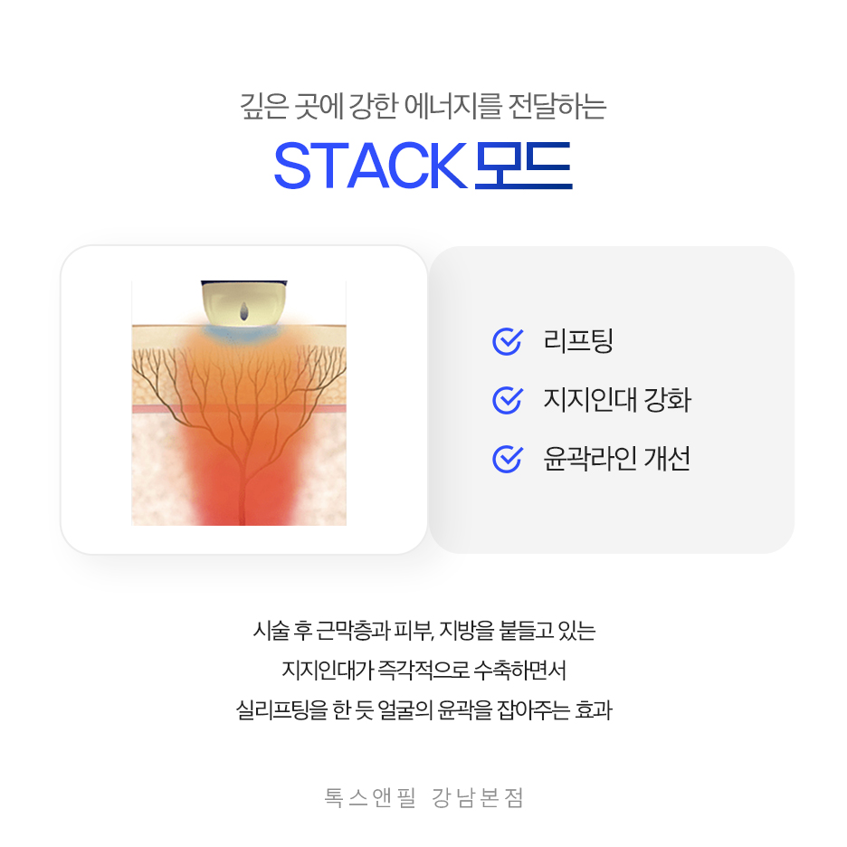 강남역 리프팅 잘하는 곳 티타늄 리프팅 왜 인기일까? 관련 이미지 3