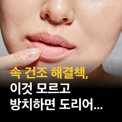강남역 스킨바이브 속 건조 해결책, 이것 모르고 방치하면 도리어... 관련 이미지 10