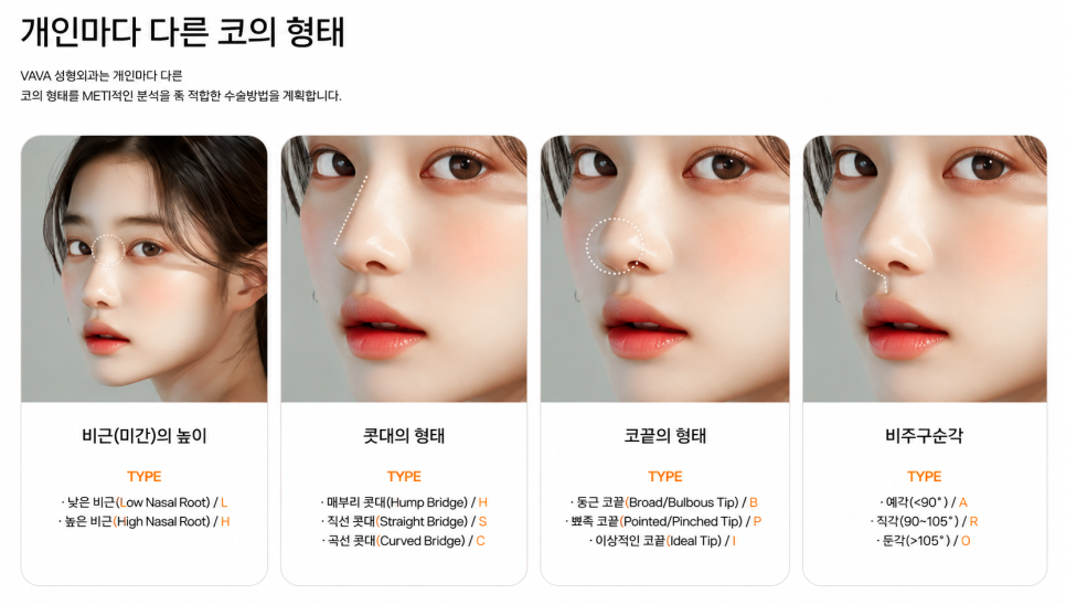 복코, 매부리코, 낮은코 | 바바성형외과 유형별 코성형, 내 코에 맞는 방향 찾기 관련 이미지 24