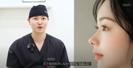 화려한 코성형, 높이만이 답일까?｜압구정 바바성형외과 코성형 꿀팁 관련 이미지 15
