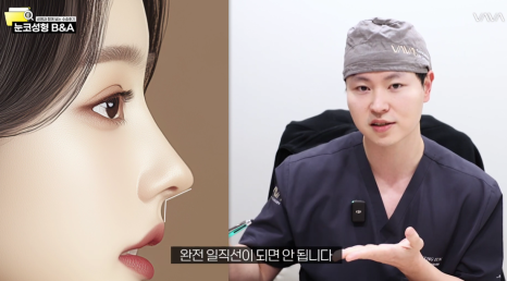 복코 매부리코 긴코 교정 ㅣ 코성형 전후 케이스 (NJZ민지 코) 관련 이미지 20