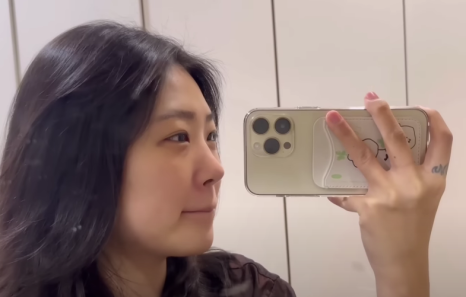 최준희 코 재수술 눈 재수술 성형 분석 관련 이미지 3