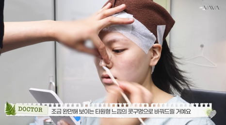 보형물 없이 선명하게｜바바성형외과 무보형물 매부리코 교정 리얼 후기 관련 이미지 9