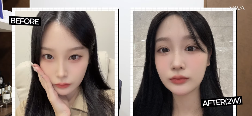 과하지 않게 또렷한 눈매, 세미아웃라인&middot;인아웃라인 쌍꺼풀 인기 이유 관련 이미지 13