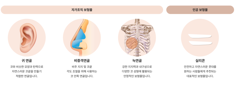 코 재수술, 첫 수술보다 더 신중해야 하는 이유 관련 이미지 12