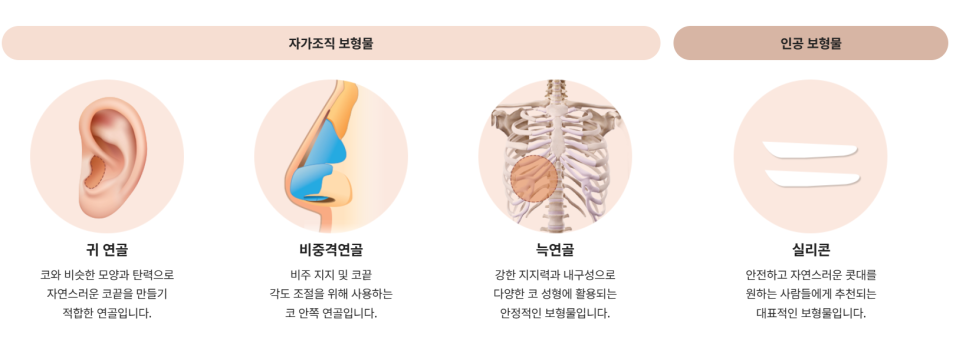 무보형 코성형 잘 어울리는 유형 관련 이미지 5