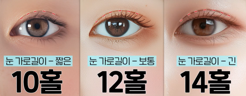 자연유착 vs 매몰 쌍꺼풀, 같은 비절개인데 왜 다를까요? 관련 이미지 5