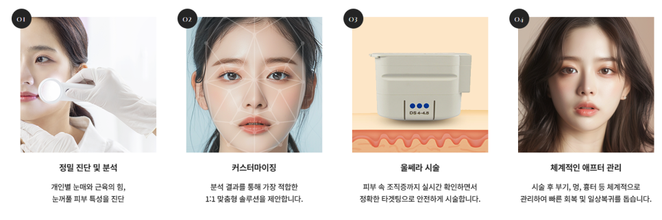 울쎄라 효과 언제부터? 윤곽까지 바뀌는 리프팅, 압구정 바바성형외과(리얼후기) 관련 이미지 13