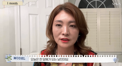 50대에도 자신감 가득 엄마의 두번째 리즈시절, 중년 눈성형&middot;하안검&middot;이마거상 리얼 후기 관련 이미지 11