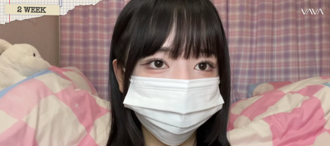 졸려보이는 눈 자연유착 밑트임 위트임으로 또렷하게 (리얼 후기) 관련 이미지 12