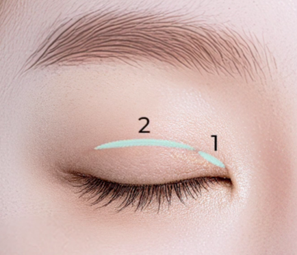 쌍수만으로 충분할까? 윗트임 병행이 필요한 경우 관련 이미지 17