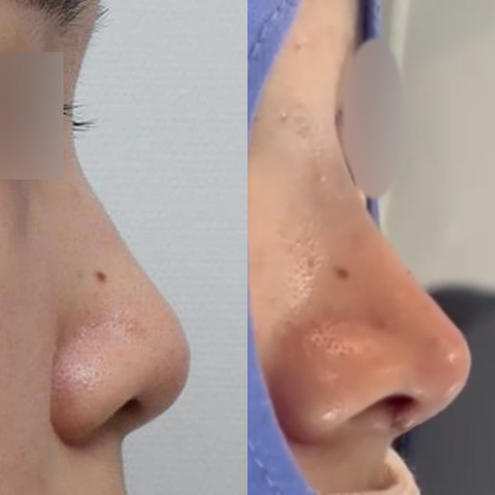 코유형에 따른 인상 관련 이미지 4