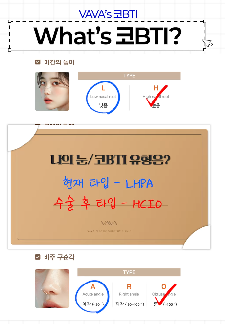 코 성형 후 붓기 기간과 붓기 관리방법 관련 이미지 10