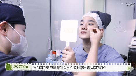 무보형물 직선라인 코성형으로 주먹코&middot;복코 개선｜압구정 바바성형외과 사례 관련 이미지 20