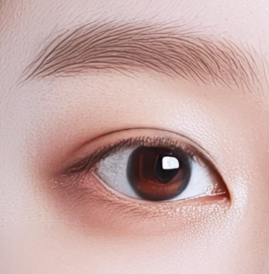 쌍수만으로 충분할까? 윗트임 병행이 필요한 경우 관련 이미지 8