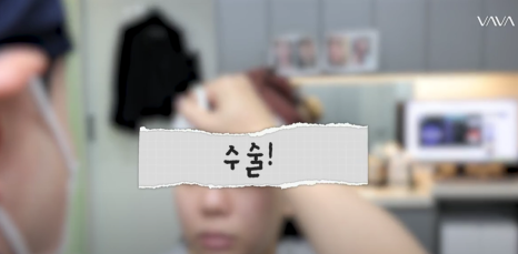 화려와 자연스러움의 중간 자려라인의 정석 직반라인 코 성형 관련 이미지 9