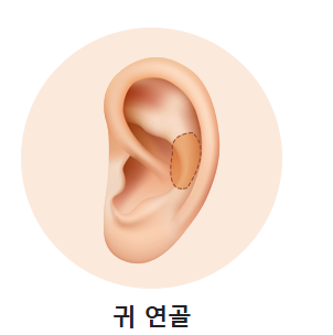 입체적이고 균형 잡힌 코 라인을 위한 자가연골 코 성형(비중격, 귀연골, 늑연골) 관련 이미지 5