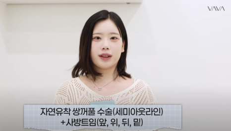 바바성형외과 눈&middot;코 성형 한 달 차 리얼 케이스 (윈터, 카리나 코) 관련 이미지 5