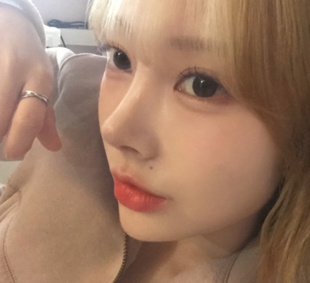 코 재수술, 첫 수술보다 더 신중해야 하는 이유 관련 이미지 18