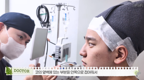 무보형물 직선라인 코성형으로 주먹코&middot;복코 개선｜압구정 바바성형외과 사례 관련 이미지 9